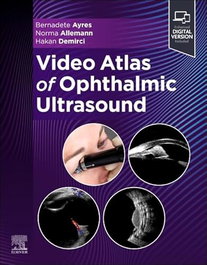 Video atlas of ophthalmic ultrasound, AA.VV. - ELSEVIER UK