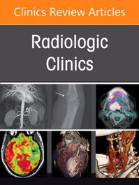 ELSEVIER UK IMAGING OF BONE SOFT TISSUE TUMORS THEIR MIMICKERS