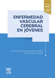 ELSEVIER EDITORIAL ENFERMEDAD VASCULAR CEREBRAL EN JOVENES