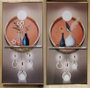 DKD Home Decor Cuadro de Aluminio y MDF con Diseño de Jarrones (Pack de 2)