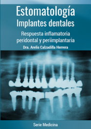 CITMATEL (IBD) Estomatología. Implantes dentales