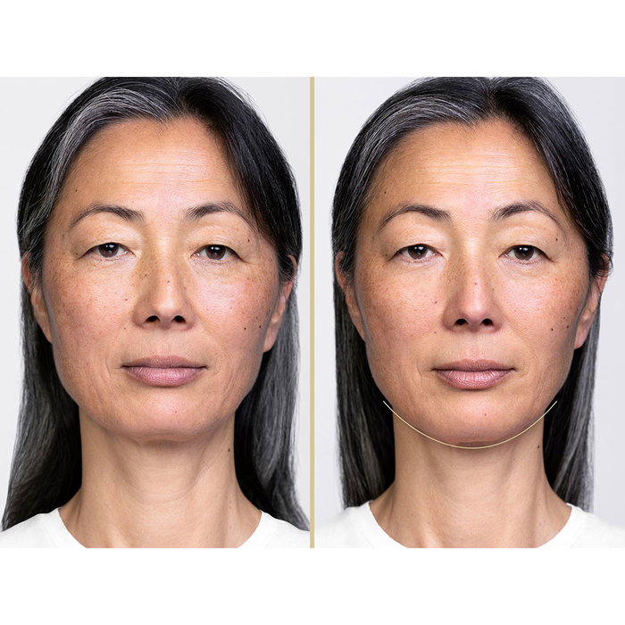 Shiseido VITAL PERFECTION lift define night serum 40 ml <M116963-712>