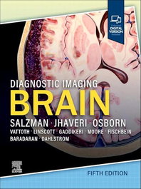 Diagnostic imaging: brain, AA.VV. - ELSEVIER UK