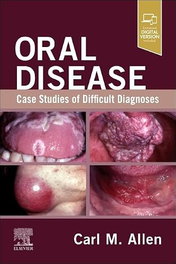 ELSEVIER UK ORAL DISEASE: CASE STUDIES OF DIFFICULT DIAGNOSES