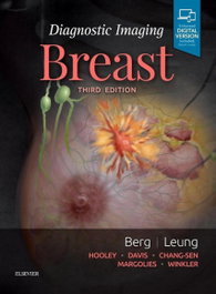 ELSEVIER UK Diagnostic Imaging: Breast