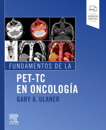 ELSEVIER EDITORIAL, Fundamentos de la PET-TC en oncología