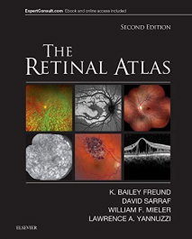 The Retinal Atlas, Freund, K. Bailey - ELSEVIER UK