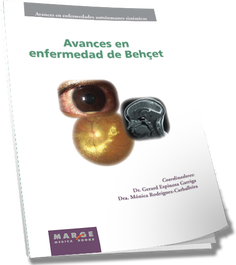 MARGE BOOKS Avances en enfermedad de Behcet