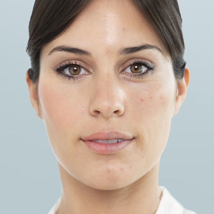 Pack Sauna Facial Eléctrica y Limpiador Facial Eléctrico de Puntos Negros InnovaGoods