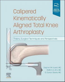 Calipered kinematically aligned total knee arthroplasty, Howell/Bini/Steele - ELSEVIER UK