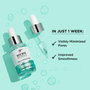 It Cosmetics BYE BYE PORES Sérum con Ácido Glicólico para Poros y Acné 30 ml