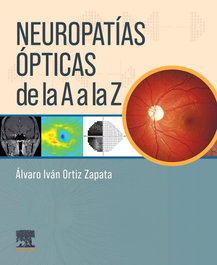 ELSEVIER EDITORIAL Neuropatías ópticas de la A a la Z