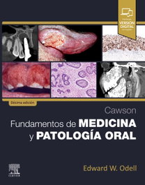 ELSEVIER EDITORIAL Cawson.fundamentos de medicina y patologia oral
