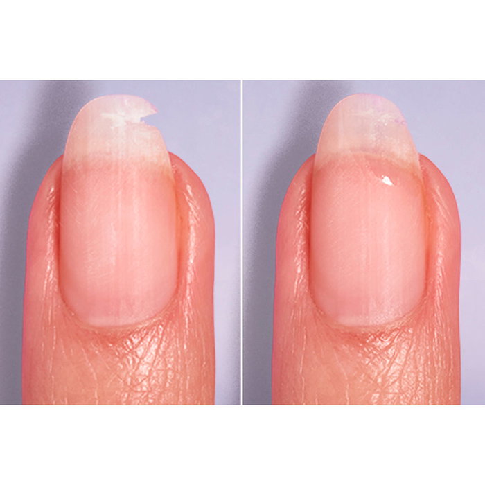 Essie BREAK FIX Liquid Nail Patch - Tratamiento Fortalecedor para Uñas, 7 ml Essie BREAK FIX Liquid Nail Patch - Tratamiento Fortalecedor para Uñas, 7 ml