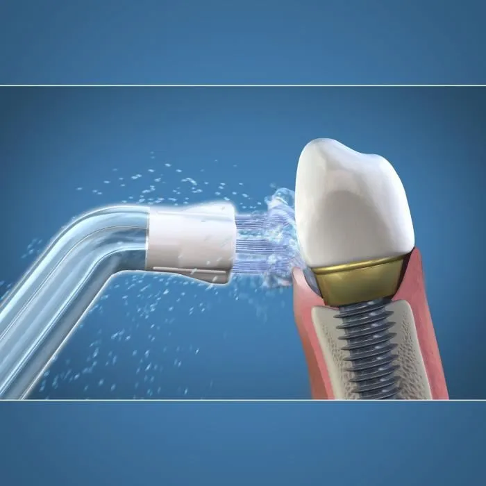 Waterpik Boquilla Seeker para placa inaccesible, 2 unidades