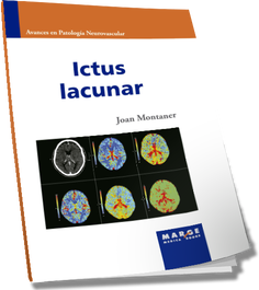 MARGE BOOKS ICTUS LACUNAR