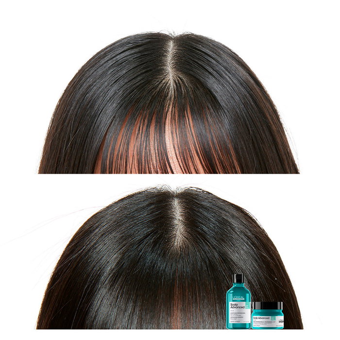 L'Oréal Professionnel Paris Scalp Advanced Clay 2 en 1 Champú y Mascarilla 250 ml L'Oréal Professionnel Paris Scalp Advanced Clay 2 en 1 Champú y Mascarilla 250 ml