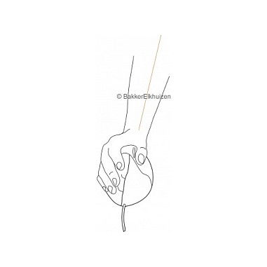 Evoluent BakkerElkhuizen4 Ratón Ergonómico Vertical para Diestros, 6 Botones, Láser, 2600 DPI, Negro/Púrpura