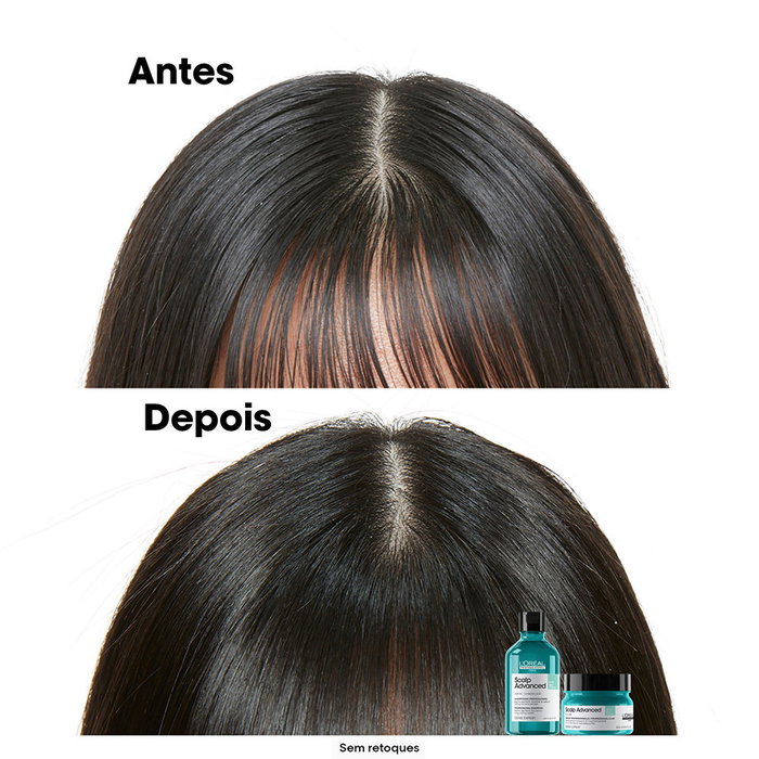 L'Oréal Professionnel Paris Scalp Advanced Shampoo para Cuero Cabelludo Graso 500 ml