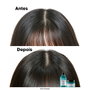 L'Oréal Professionnel Paris Scalp Advanced Shampoo para Cuero Cabelludo Graso 500 ml