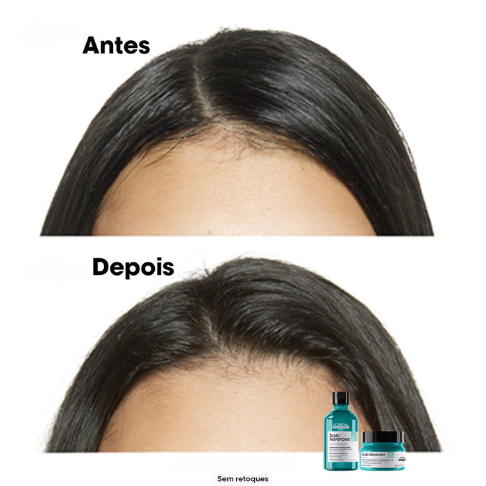 L'Oréal Professionnel Paris Scalp Advanced Shampoo para Cuero Cabelludo Graso 500 ml