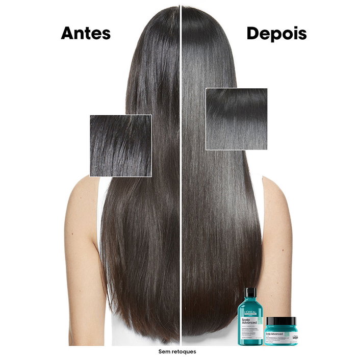 L'Oréal Professionnel Paris Scalp Advanced Shampoo para Cuero Cabelludo Graso 500 ml