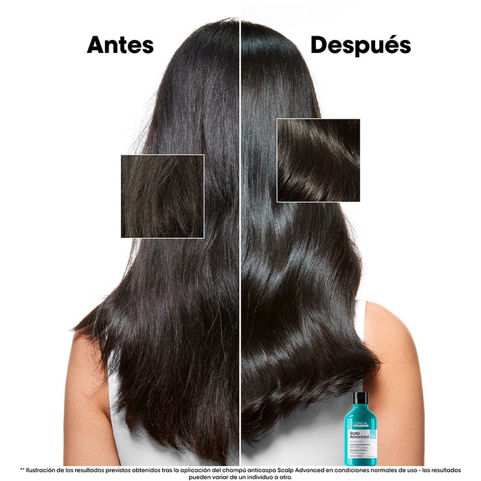 L'Oréal Professionnel Paris Scalp Advanced Champú Anticaspa 300 ml L'Oréal Professionnel Paris Scalp Advanced Champú Anticaspa 300 ml