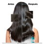 L'Oréal Professionnel Paris Scalp Advanced Champú Anticaspa 300 ml