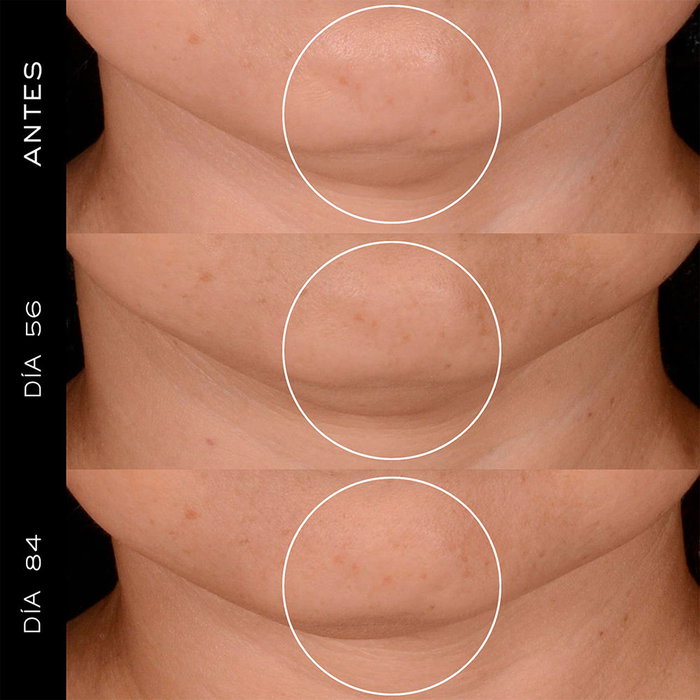 Lancôme Rénergie HPN 300 Crème Régénérante aux Peptides 75 ml