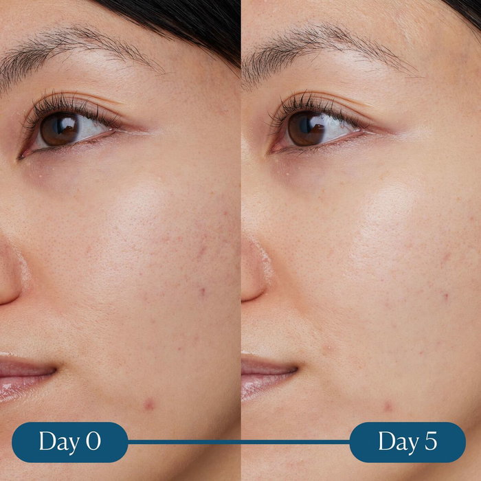 Elemis Dynamic Resurfacing Super-C Sérum 30 ml