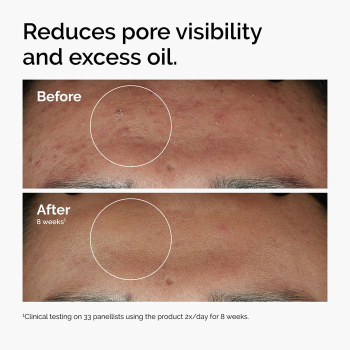 The Ordinary Niacinamide 10% + Zinc 30 ml The Ordinary Niacinamide 10% + Zinc 30 ml