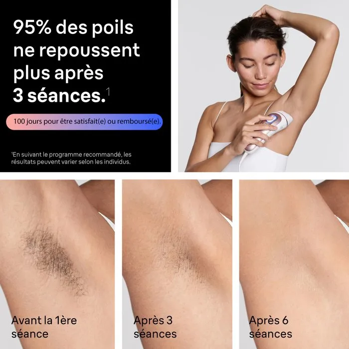 Braun Skin i-expert PL7431 Épilateur à lumière pulsée IPL avec capteur SkinProtect - Blanc et Rose Gold