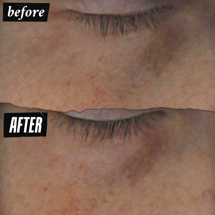 Kiehl's Sérum Contour des Yeux à la Vitamine C Réducteur de Rides