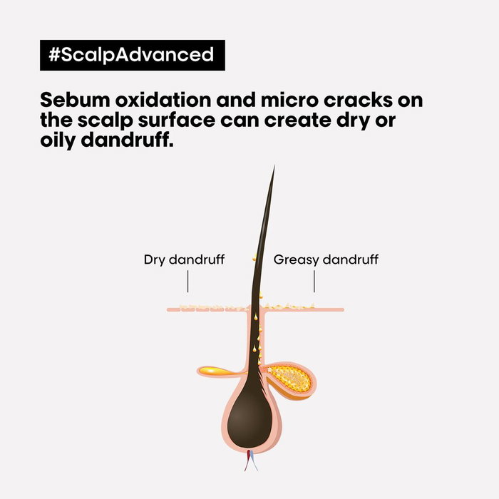 L'Oréal Professionnel Paris Scalp Advanced Shampooing Antipelliculaire et Purifiant 300 ml