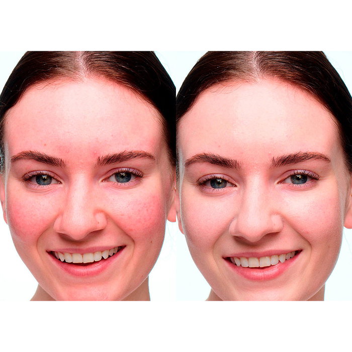 Dr.Jart+ Cicapair Gouttes Calmantes Camo Drops SPF 20, Sérun Teinté Apaisant pour Rougeurs et Peau Sensible, 30 ml