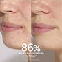 Caudalie Vinopure Sérum Anti-imperfections 30 ml
