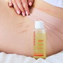 Topicrem CICA Huile cicatrices et vergetures 100 ml