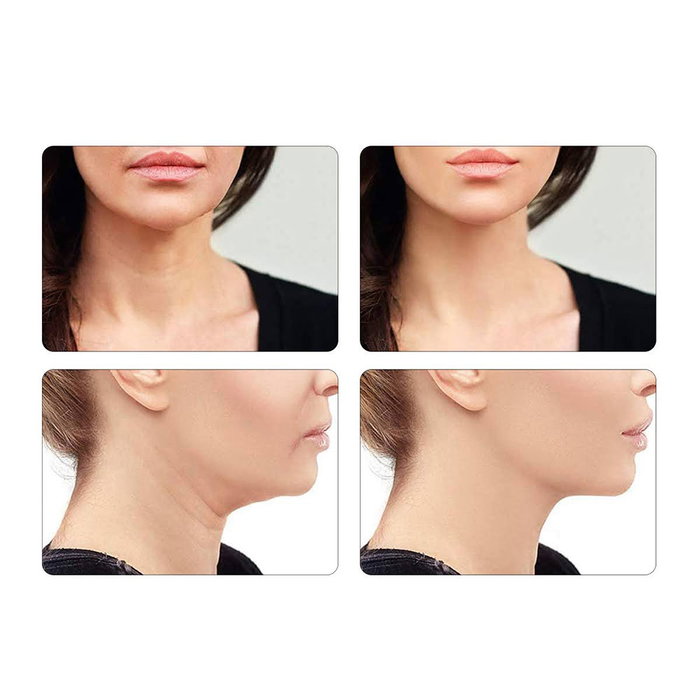 Paloma Beauties Appareil de Beauté Visage et Cou Anti-Âge avec Chaleur 45°C, Lumières LED Rouge Bleue Verte et Massage Vibrations Haute Fréquence