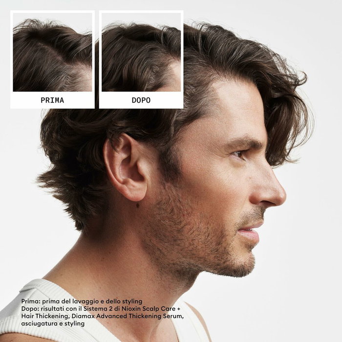 Nioxin System 2 - Kit de traitement pour cheveux naturels avec amincissement avancé, 3 unités Nioxin System 2 - Kit de traitement pour cheveux naturels avec amincissement avancé, 3 unités