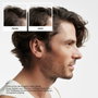 Nioxin System 2 - Kit de traitement pour cheveux naturels avec amincissement avancé, 3 unités
