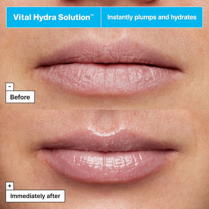 Dr.Jart+ VITAL HYDRA SOLUTION Masque hydratant pour les lèvres 20 ml