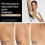 Braun Silk Expert Pro 5 PL5221 Épilateur à Lumière Pulsée IPL avec Capteur SkinProtect - Blanc et Or