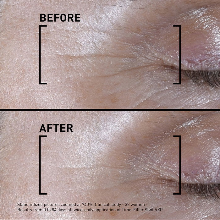 Laboratoires Filorga TIME-FILLER SHOT 5XP Sérum Concentré Correction Rides d'Expression 15 ml Laboratoires Filorga TIME-FILLER SHOT 5XP Sérum Concentré Correction Rides d'Expression 15 ml
