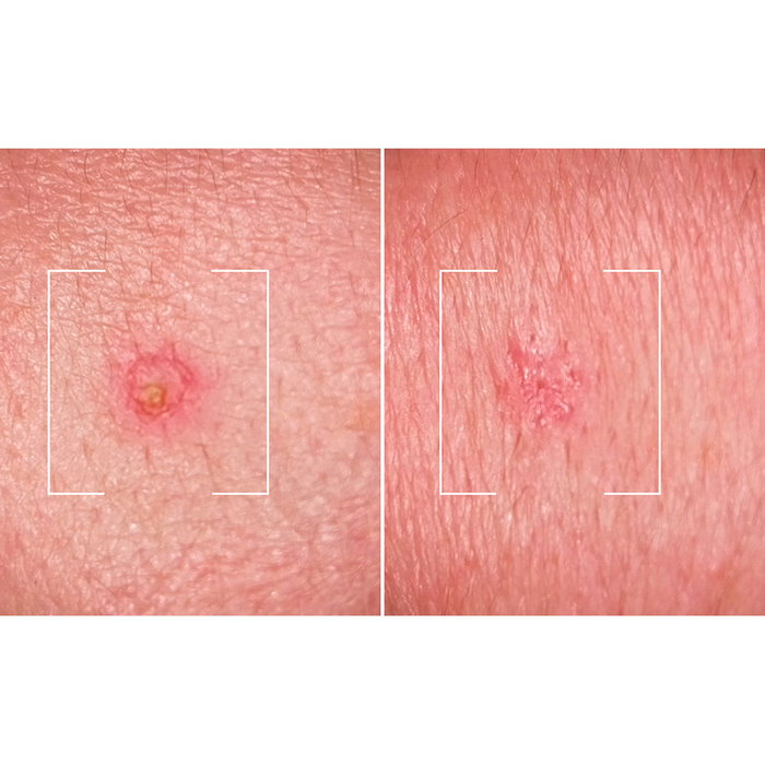 L'Oréal Paris Men Expert Derma Control Solution SOS anti-imperfections 45 ml