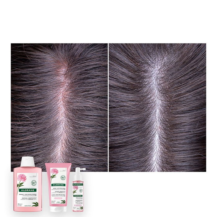 Klorane Après-shampooing Apaisant à la Pivoine BIO - Soin pour Cuir Chevelu Sensible, Anti-irritant, 150 ml