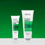 Vichy DERCOS Shampooing Antipelliculaire Cheveux Gras 95 ml