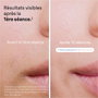 Braun PL7253 Épilateur à lumière pulsée IPL - Or rose et blanc
