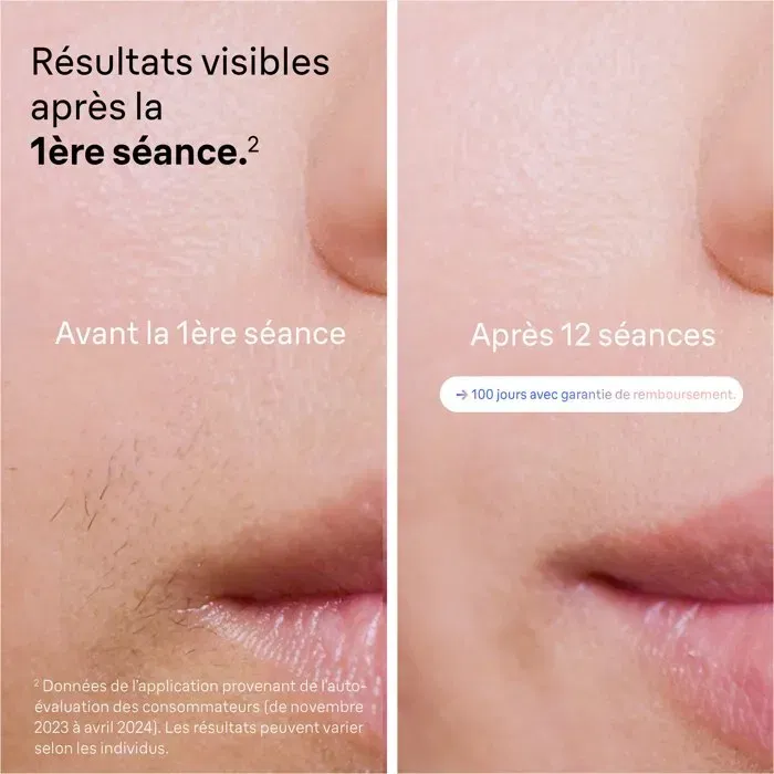 Braun PL7253 Épilateur à lumière pulsée IPL, 400000 Flashs, Technologie Intelligente, Design Or Rose et Blanc, pour Corps et Visage, 240V