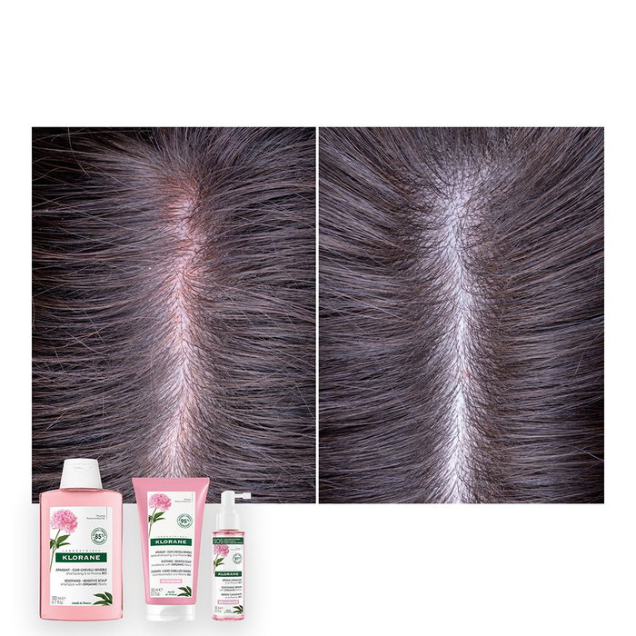 Klorane Shampoing Apaisant à la Pivoine Bio 400 ml Klorane Shampoing Apaisant à la Pivoine Bio 400 ml