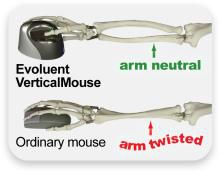 Evoluent VerticalMouse 4 Small - Souris Verticale Érgonomique - 6 Boutons Programmable - Capteur Laser - Compatible Windows XP/7/Vista - USB